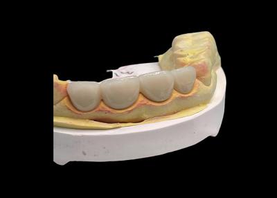 China Long lasting Wear resistant Strength all Ceramic Crown Bridge with Excellent Biocompatibility for dental restoration for sale
