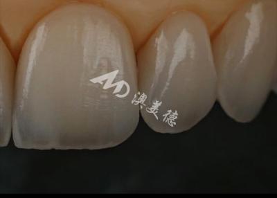 China Chipping Resistance Zirconia Dental Crown For Anterior Teeth / Posterior Teeth for sale