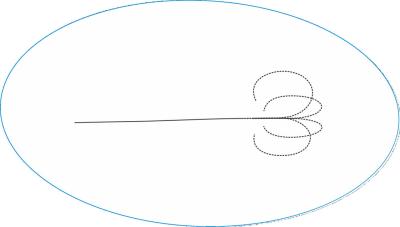 Κίνα Τύπος ΙΙ Pebax ψηφιακό εύκαμπτο Ureteroscope μίας χρήσης 8.5Fr προς πώληση