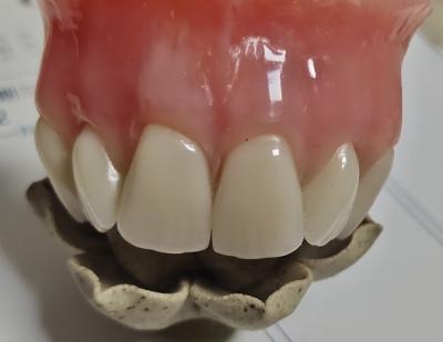China Koude van het Esthetics genas de Volledige Gebit Acryl Gedeeltelijk Gebit Te koop