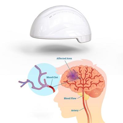 China Máquina Transcranial de Photobiomodulation Photomedicine PBM para la mejora cognoscitiva en venta