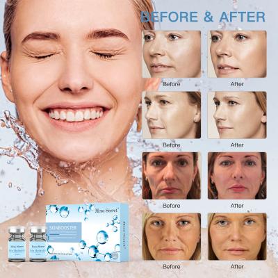 China Coreia Anti-Aging Skinbooster Ácido hialurônico Meso Secret Fillers Injecção à venda