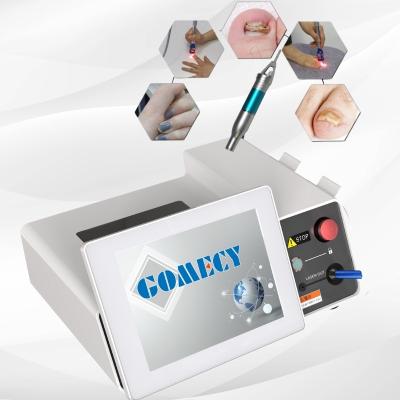 China Verwijder je van nagel schimmel met Gomecy 980nm Diode Laser Fysiotherapie Machine Blauw Licht Therapie Pen Te koop