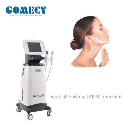 China Oro RF Microneedle-Machine Vertical Fractional RF Microneedle Tratamiento de levantamiento de cara y cuerpo en venta