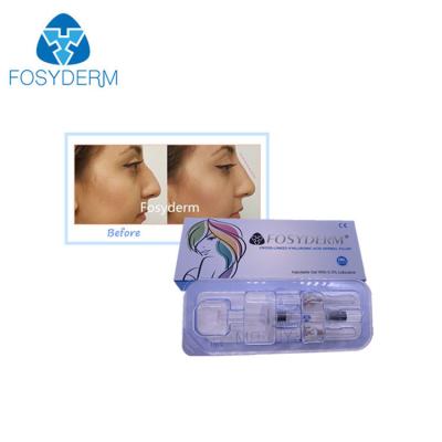China Kreuz verband injizierbaren ha-tiefen Hautfüller für genehmigtes Nasen-Chin Jawline-CER zu verkaufen