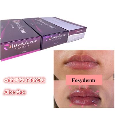China FÜLLER-Gesichts-Einspritzungen Juvederm injizierbare Füller-Ultra3 Ultra4 Voluma Haut zu verkaufen