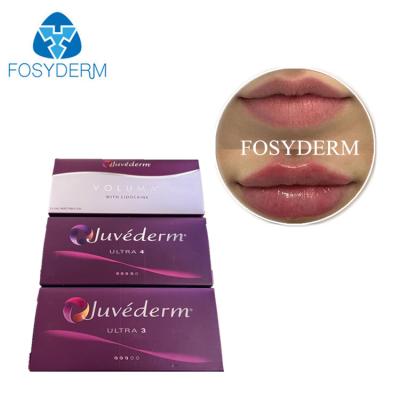 China Juvederm Dermal Filler Injection Cross Linked Hyaluronic Acid HA Gel Gezicht Filler Voorgevulde Spuit Te koop