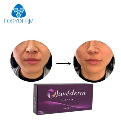 China Juvederm-Kreuz verband Hyaluronsäure-Hautfüller Allergan ultra 4 zu verkaufen