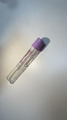 중국 높은 정확성 세포 없는 DNA 광범위한 커버리지 액체 생검 판매용
