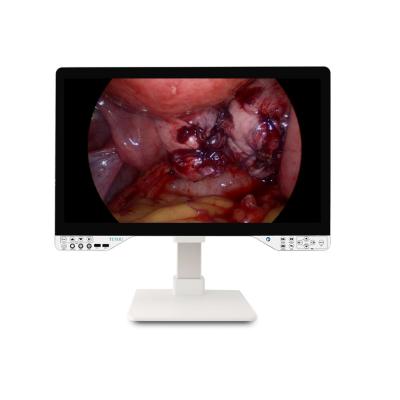 China 27 polegadas FHD 1080P Endoscópico Sistema de Câmera Somente Endoscópio rígido com 15,6 polegadas monitor e 100W de potência óptica efetiva à venda