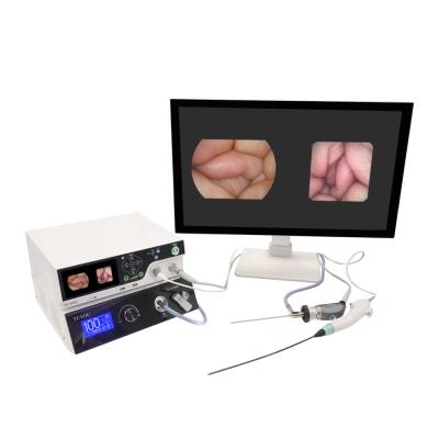 Cina TUYOU Manufacturer 1080P Imaging Equipment With Rigid And Flexible Endoscopy Camera System per le ENT in vendita