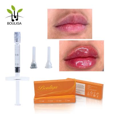 China Kreuz verband 1 ml-Hyaluronsäure-Lippeninjizierbaren langlebigen Hautfüller zu verkaufen