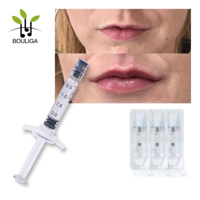 China Cer-Kreuz verband natürliche Hautfüller-Einspritzung 5ml zu verkaufen