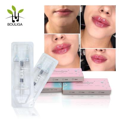 China Hauthyaluronsäure-Füller der Lippen1ml 2ml 10ml injizierbar zu verkaufen