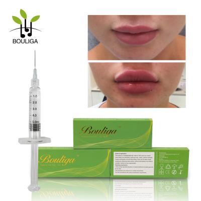 China A cruz do Oem 5ml ligou o enchimento ácido hialurónico remove o enrugamento facial injetável à venda