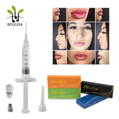 China A cruz injetável do gel de GA ligou o enchimento ácido hialurónico 1ml à venda