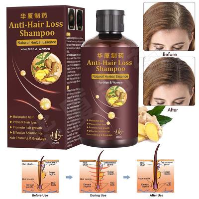 China Ayudas del champú del espesamiento del pelo del champú de la pérdida de pelo de la etiqueta privada parar pérdida de pelo en venta