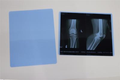 Chine High Definition 8*10 Inch Dry Imaging Film Agfa 5302 Printer Medical Xray Film à vendre