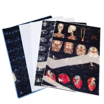 China High Resolution Blue White Medical X Ray Films With Glossy Surface Finish for sale