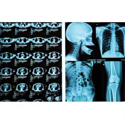 Chine Medical X Ray Film Blue Film For FUJI Agfa Thermal Printers à vendre