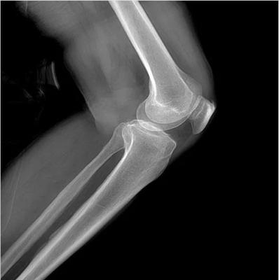 Chine Cr Dr Thermal Medical X Ray Film Digital Medical X-Ray Film Hospital Dry Thermal Film à vendre