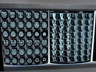 China Blue Thermal Print Medical Laser X Ray Film For Accurate Diagnosis for sale
