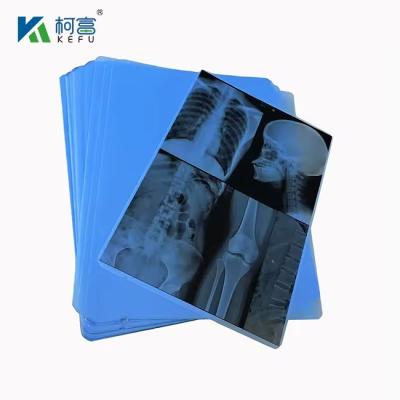 China Bolsa de Raios X Médicos de Alta Qualidade e Película Verde 8*10in\20*25cm Para Película Verde de Raios X à venda