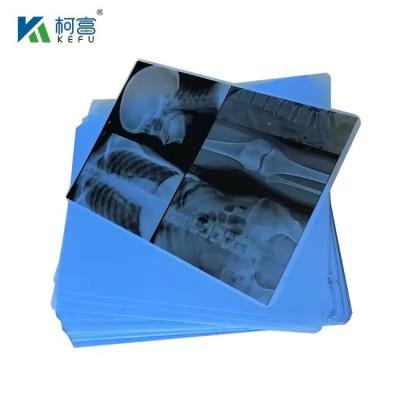 China A4 Tinta Médica Jet Blue Film X-Ray PET Film X-Ray Paper à venda