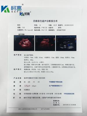 Chine Film sec médical transparent à jet d'encre Film blanc à rayons X pour appareil radiologique IRM à vendre