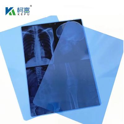 China Película de laser médica fácil de manusear e flexível, 13x17 polegadas, 0,15 mm, com uma textura de superfície lisa e resistente à dobra à venda