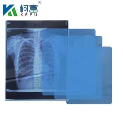 China Filme de laser médico resistente à água e a produtos químicos, 10x14 polegadas, 0,13 mm, adequado para uso em ambientes médicos duros e úmidos à venda