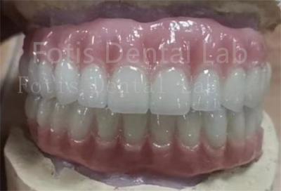 China Precise Fit Ivoclar Teeth Acrylic Complete Denture Stain Resistant for sale