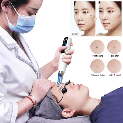 China Pigment Removal Mini Laser Mole Removal Whitening Laser Beauty Pen Portable for sale