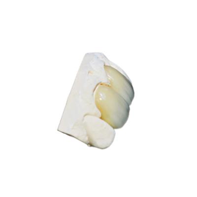 China Durable Full Ceramic Zirconia Crown Thin Beautiful Custom Shape for sale