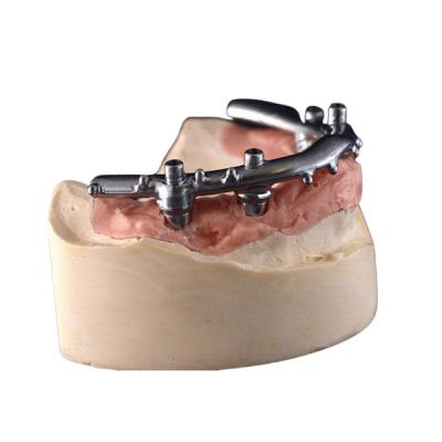 China High-Density PFM Dental Implants Dentures Strong Hardness Long Lasting for sale
