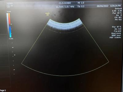 China GE Logiq S7 convexa de la matriz original de la sonda transductor de ultrasonido C1-5-D en venta