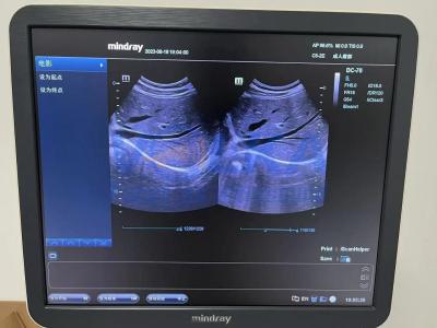Chine Réparation Mindray C5-2E DC-70 sonde OB/GYN convexe C5-2E à vendre