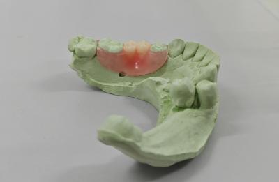 China Ervaar de voordelen van onzichtbaar hars voor lichte en betaalbare producten Te koop