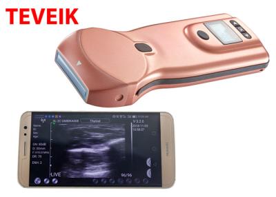 China Ultrassom sem fio de Wifi da ponta de prova do ultrassom de Doppler da cor para Iphone/Android/USB à venda