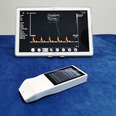 China Carregamento sem fio da ponta de prova sem fio do ultrassom de Doppler da cor de Tranducer Android do ultrassom à venda