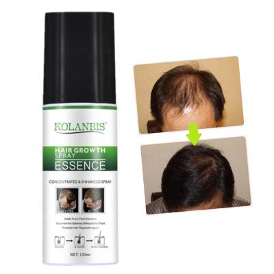 China Hair Loss Prevention Hair Care Hair Growth Essentials Oils Extract Product Fast Hair Growth Serum Private Label for sale