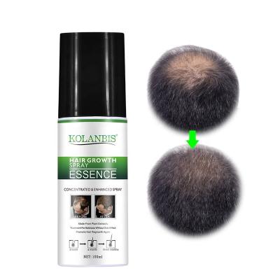 China Top 10 Loss Prevention Hair Growth Spray Improve Hair Regrowth Oil Wholesale For Hair Loss for sale