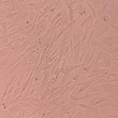 China Research Function Stem Cells Liquid Nitrogen Storage For Cell Culture Conditions for sale