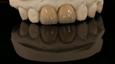 China Full Contour Zirconia Crown and High Aesthetic Natural Dental Bridge 5 Year Guarantee for sale
