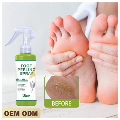 China Private Label Organic Foot Remove Dead Skin Deep Cleansing Skin Care Peeling Foot Care Gel Green Tea Foot Peeling Spray for sale