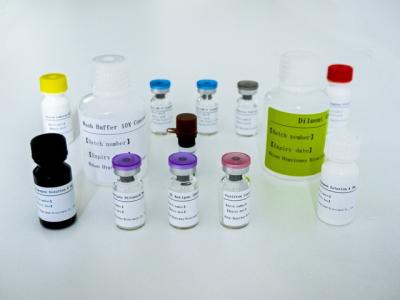 Cina Kit di prova ELISA IGRA facile da usare per la tubercolosi con lunga durata di conservazione e metodo di conservazione 2C-8C in vendita