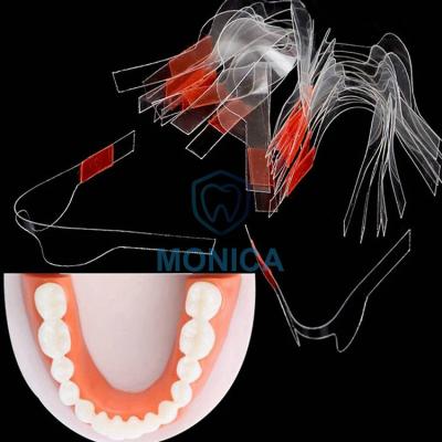 China Matrix Plastic Self Adhesive Clear Contoured Tape for Anterior Teeth, Bicuspids, Molars for sale