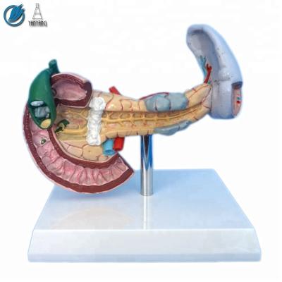 China Gallstones, Spleen and Pancreas Medical Anatomical Teaching Model for sale