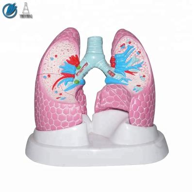 China Plastic Human Anatomical Medical Biology Lung Model for sale