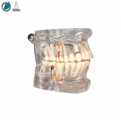 China Medical science medical human subject dental anatomical model for sale